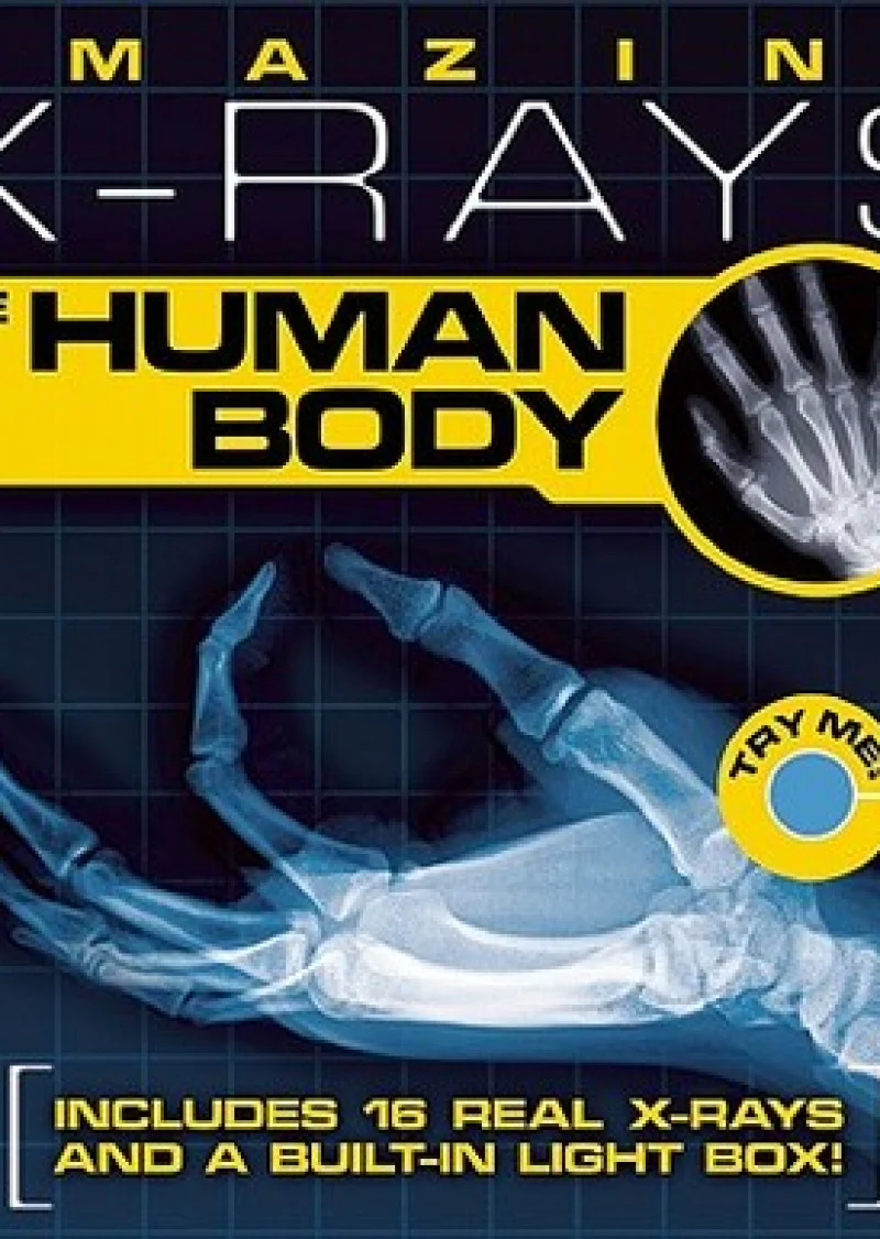 Amazing X-Rays: The Human Body